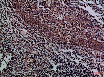CD158f1/2 rabbit pAb Antibody