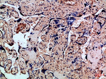 IL8RA antibody