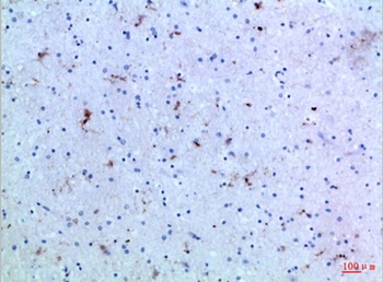 IL15 antibody