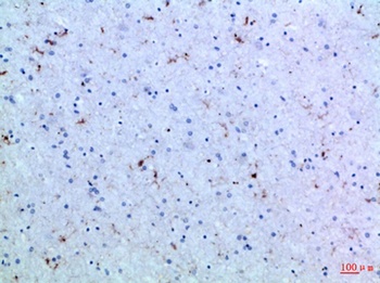 IL15 antibody