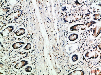 MCP-3 antibody