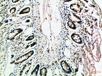 MCP-3 antibody