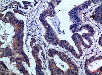 IL17F antibody