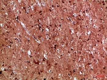 IL17D antibody