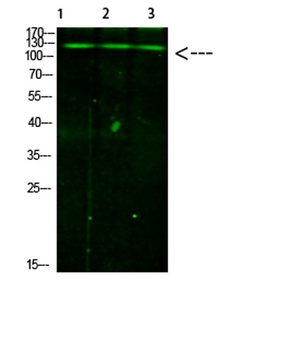 JAK2/3 (Phospho-Tyr966/939) Antibody