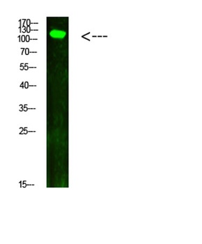 JAK2/3 (Phospho-Tyr966/939) antibody