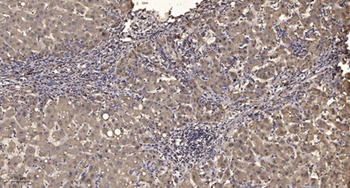 JAK2/3 (Phospho-Tyr966/939) antibody