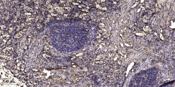 LIM and SH3 domain protein 1 rabbit pAb