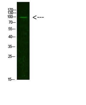 AR(Acetyl-K631) rabbit pAb Antibody
