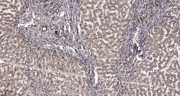 Rb (Acetyl-K873/K874) rabbit pAb Antibody