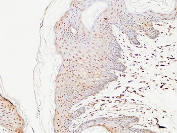 TRX antibody