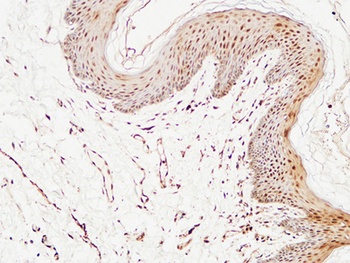 TRX antibody