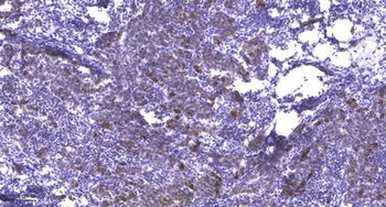 MYL2 antibody