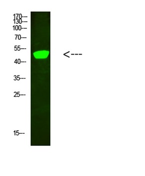 C1RL rabbit pAb Antibody