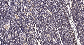 SYK (Phospho-Tyr348) Antibody