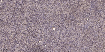Smad3 (Phospho-Ser213) Antibody