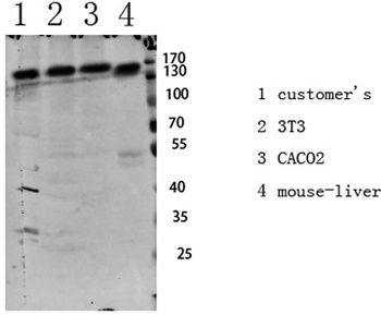 IGF1R (Phospho-Tyr1161) Antibody