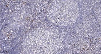 Tip60 rabbit pAb Antibody
