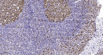 MLL4 rabbit pAb Antibody