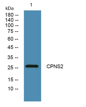 CPNS2 rabbit pAb Antibody