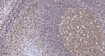 CHD6 rabbit pAb Antibody