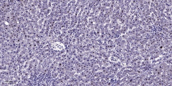 CHD9 rabbit pAb Antibody