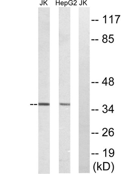 TRI63 rabbit pAb Antibody