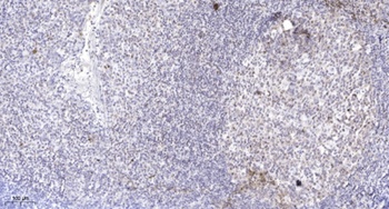 MLL2 rabbit pAb Antibody