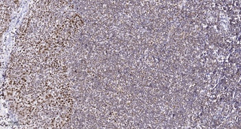 SYNE2 rabbit pAb Antibody