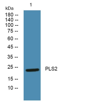 PLS2 rabbit pAb Antibody