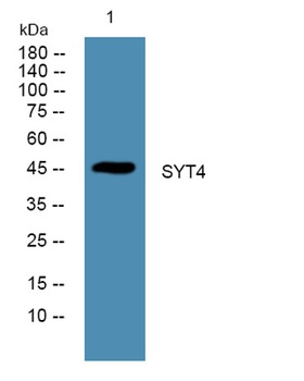 SYT4 rabbit pAb Antibody
