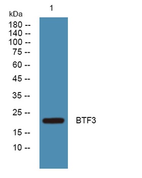 BTF3 rabbit pAb Antibody