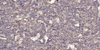 NCPR rabbit pAb Antibody