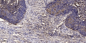 LRRK2 rabbit pAb Antibody