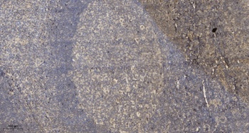 VWF rabbit pAb Antibody