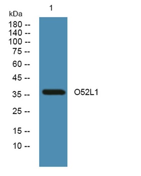O52L1 rabbit pAb Antibody