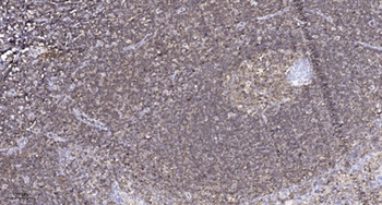 MUC3A rabbit pAb Antibody
