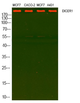 DICER rabbit pAb Antibody