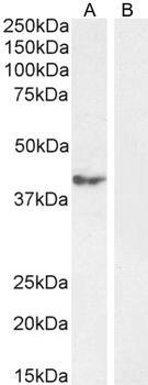 Goat anti-Calcipressin-1 Antibody