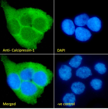 Goat anti-Calcipressin-1 Antibody