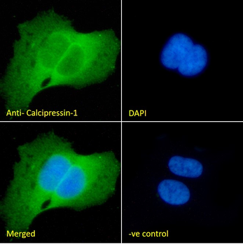Goat anti-Calcipressin-1 Antibody