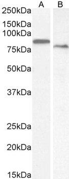 Transglutaminase 2 (aa578-591) Antibody