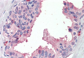 Goat anti-SRD5A1 Antibody