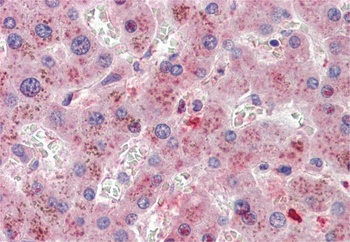 Goat anti-SRD5A1 Antibody