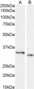 Goat anti-PIM2 Antibody