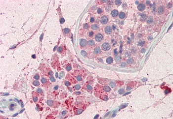 Goat anti-PIM2 Antibody