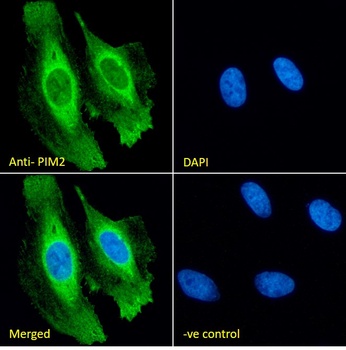 PIM2 antibody