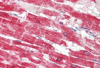 Goat anti-SERCA2 / ATP2A2 Antibody