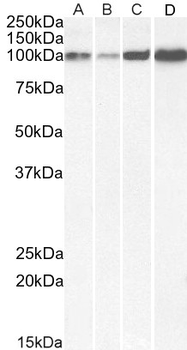 Goat anti-SERCA2 / ATP2A2 Antibody