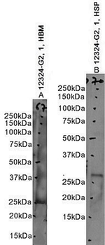 Goat anti-proteinase 3 / myeloblastin (aa88-98) Antibody